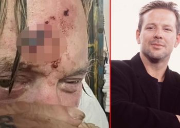 Eski günlerim geride kaldı: Ünlü oyuncudan ‘kan revan’ paylaşım… ‘Yüz hatlarımı bozup attılar’ demişti